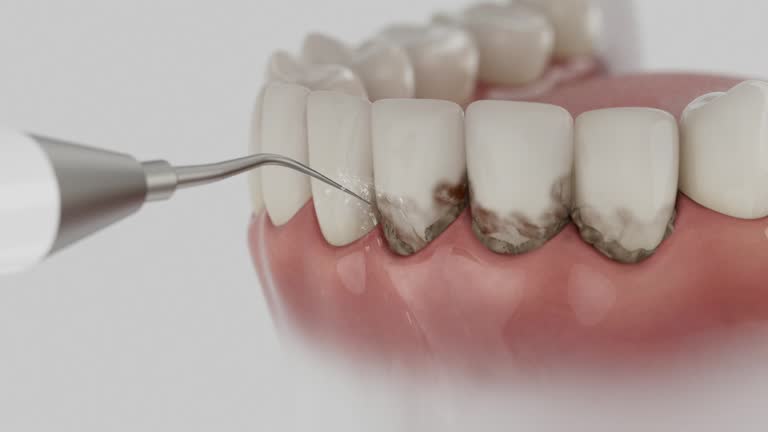 Reliable Dental Implants contractor in Silver Lakes, CA by Smile Center Dentistry
